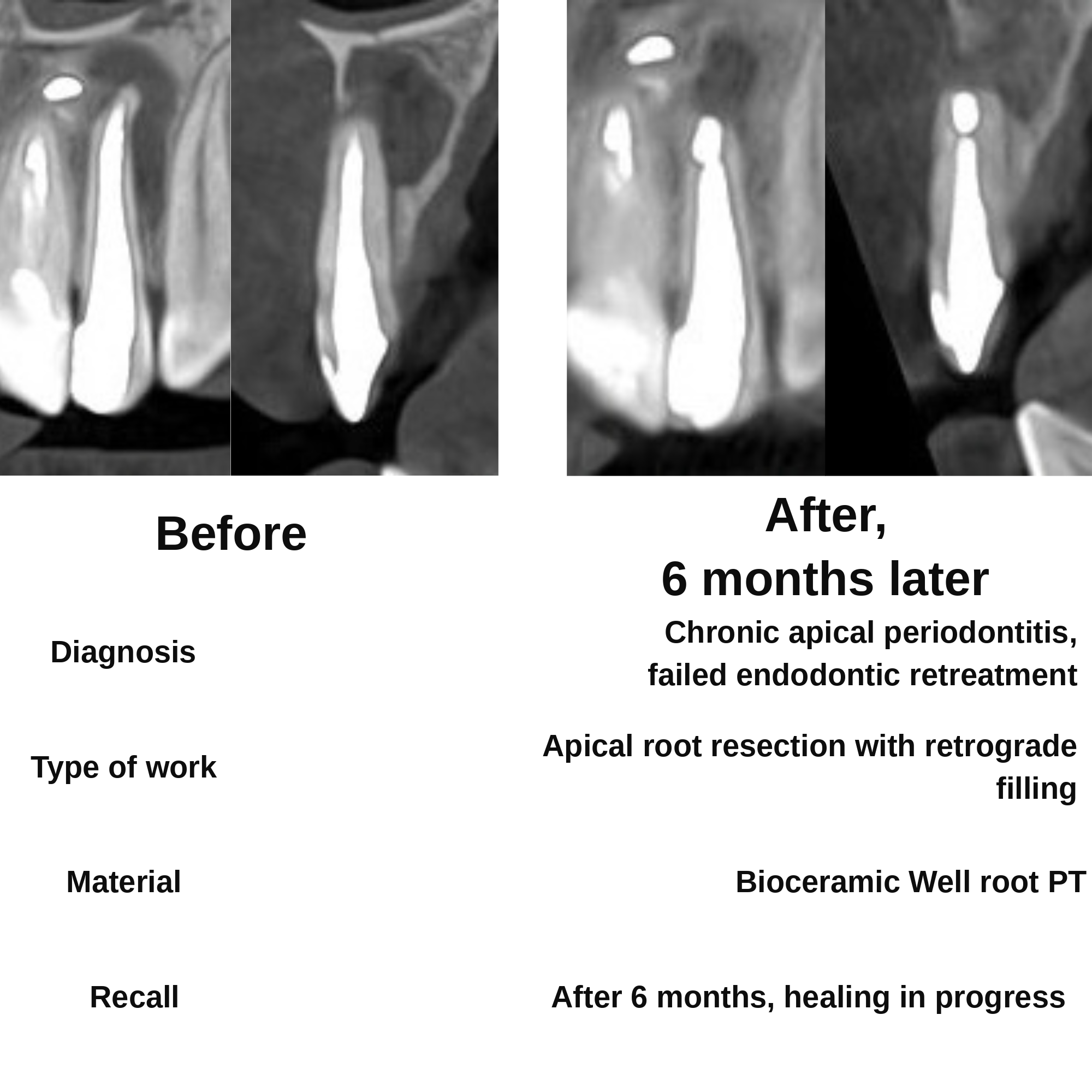 Clinical case 1
