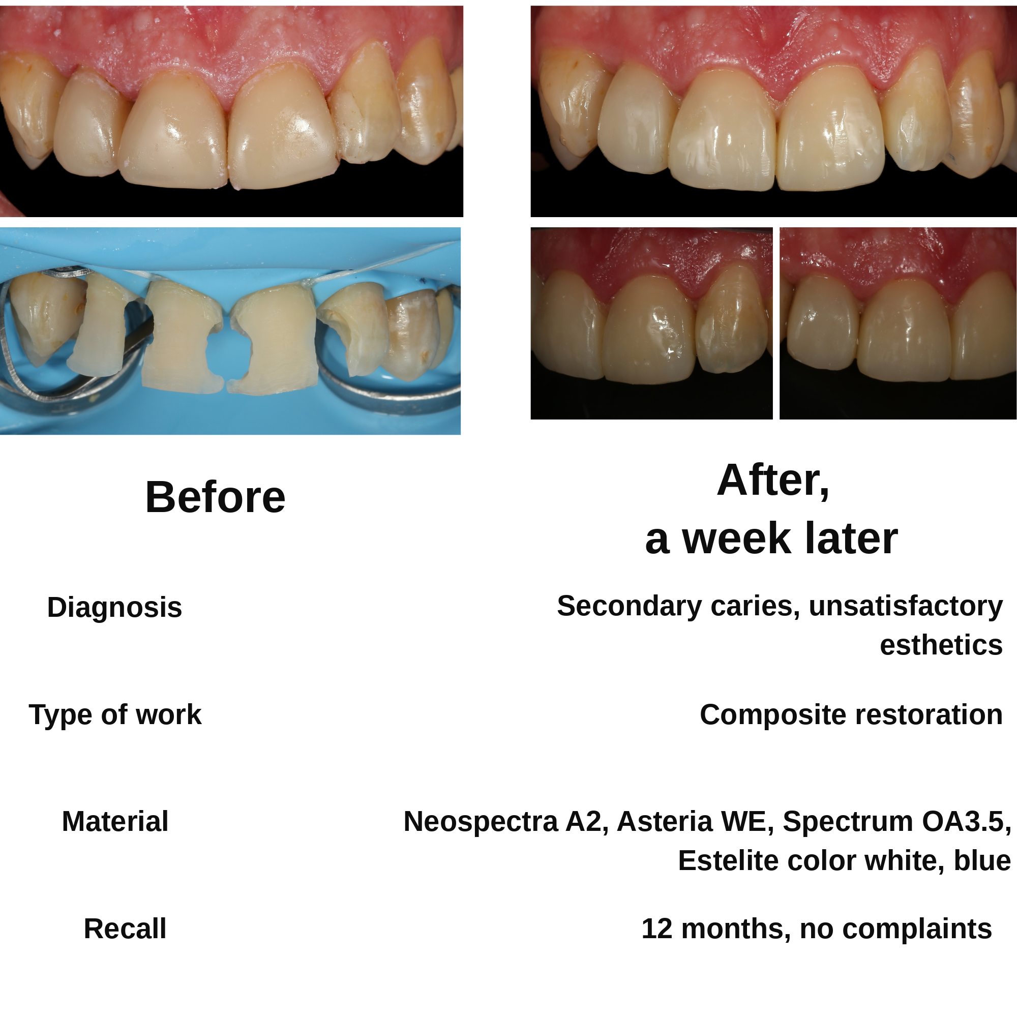 Clinical case 2