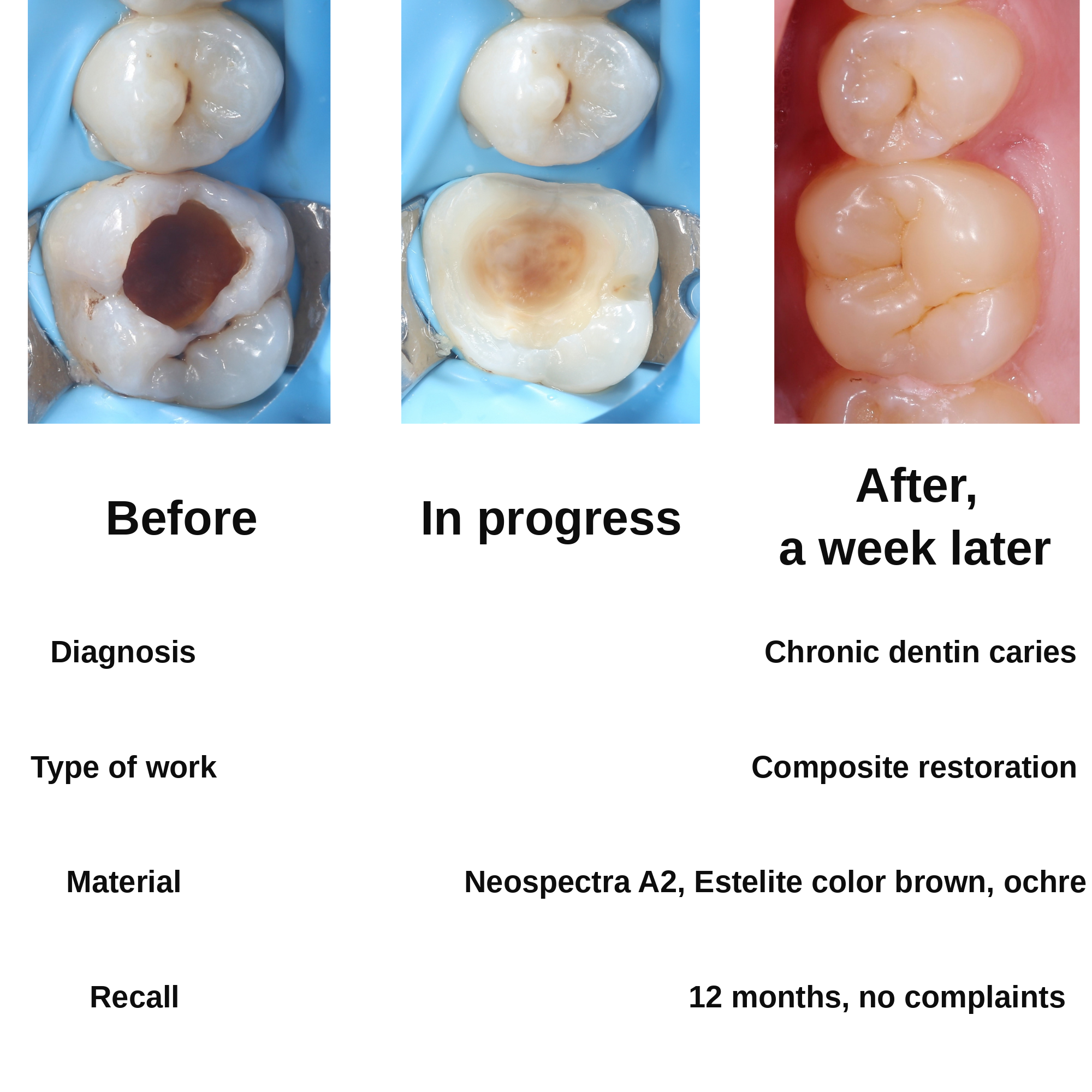 Clinical case 3