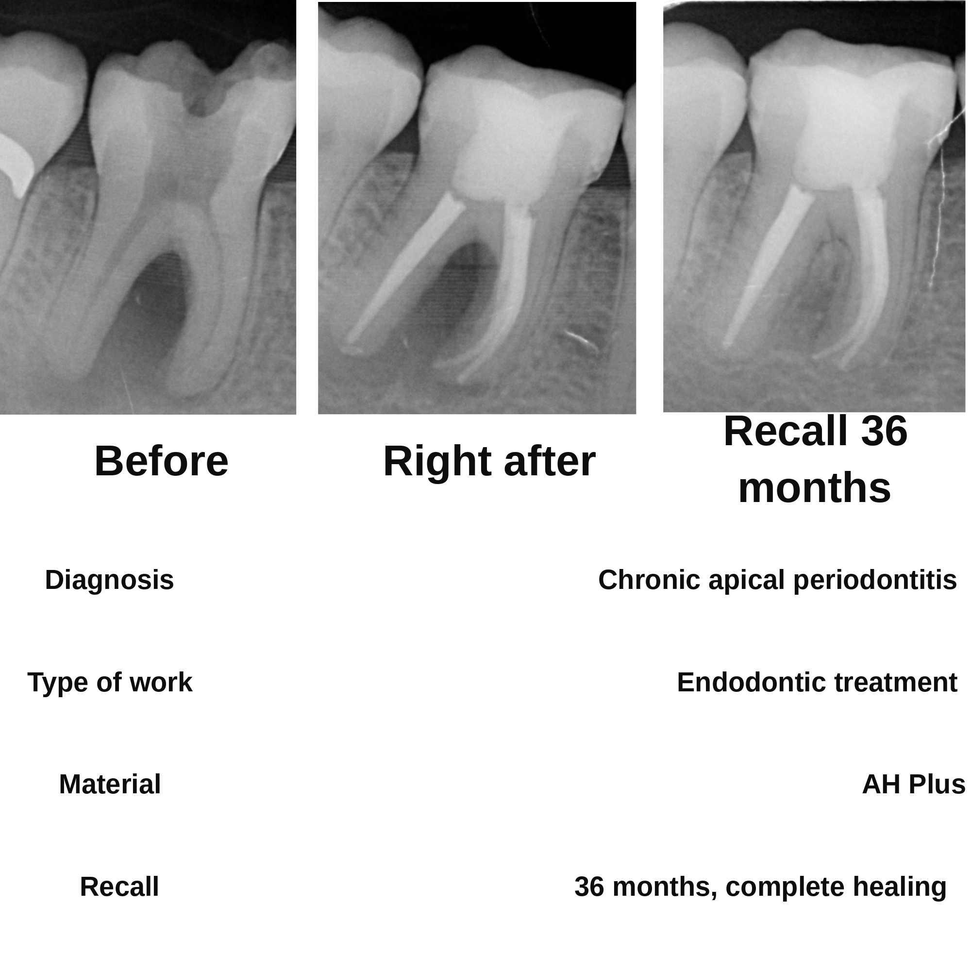 Clinical case 4