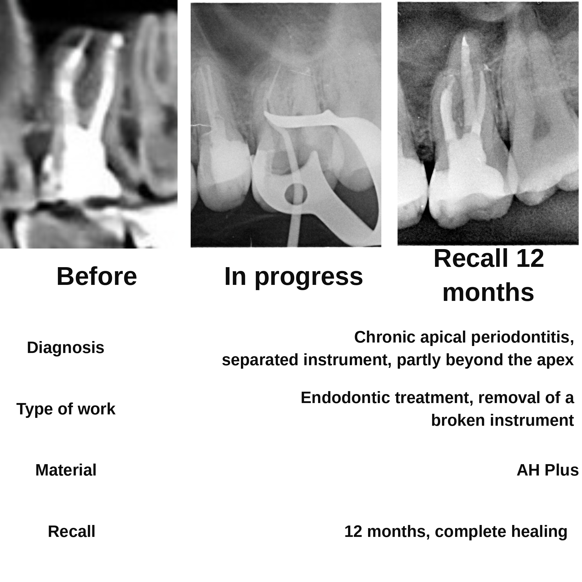 Clinical case 5