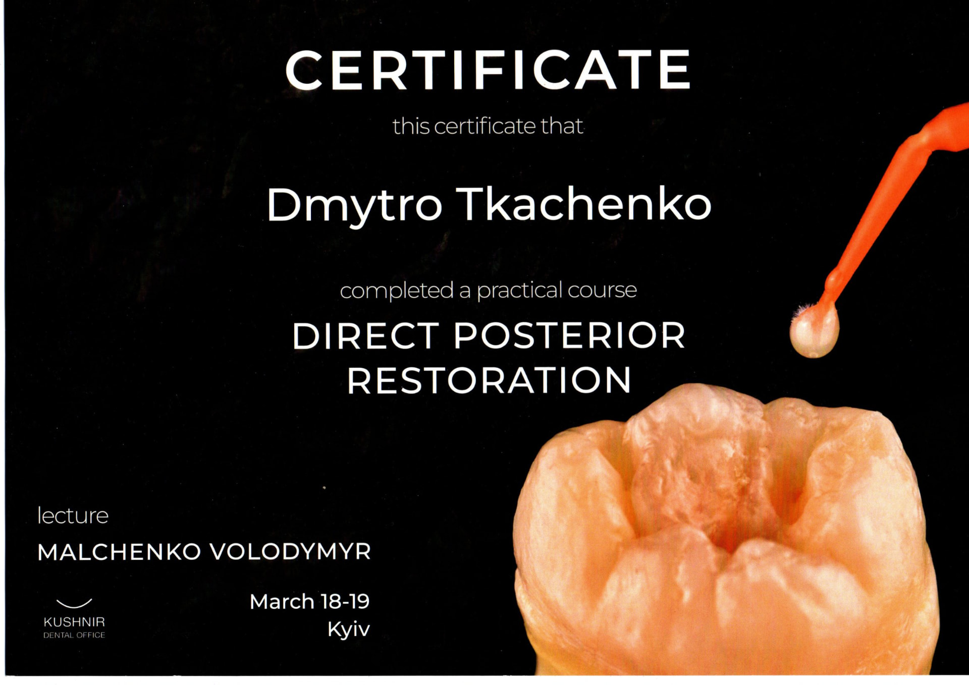 Certificate — Direct Posterior Restoration practical course, Kushnir Dental Office, Kyiv